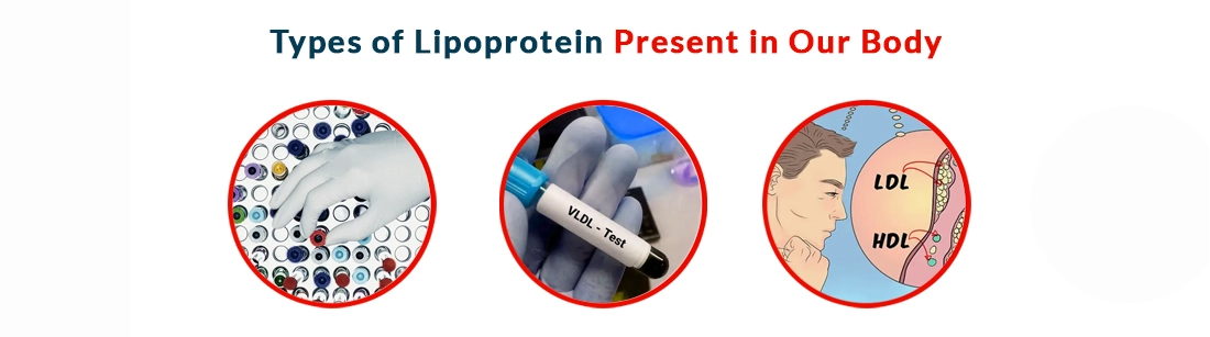 Types of Lipoprotein Present in Our Body